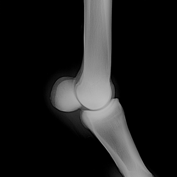Bone X-ray