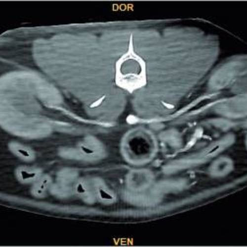 internal-organs-abdominal-diseases internal-organs-abdominal-diseases